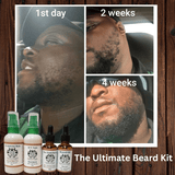 The Ultimate Beard Kit - Positive-Outlook-Grooming