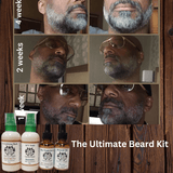 The Ultimate Beard Kit - Positive-Outlook-Grooming