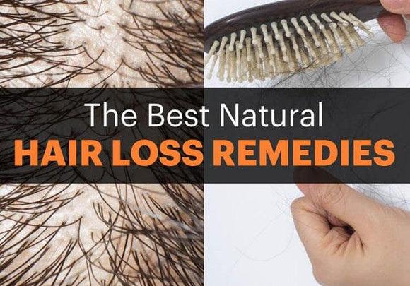 The Best Natural Hair Loss Remedies - Positive-Outlook-Grooming